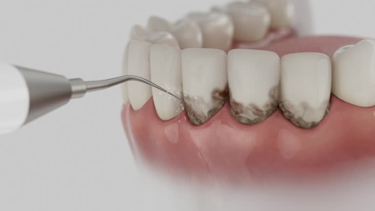Trusted Dental Crowns And Bridges service in Toro Canyon, CA - Dentist Open Now